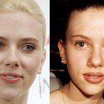 <b>백치미</b>인 스칼렛요한슨도 성형수술한 얼굴