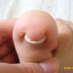 절정의 <b>내성</b> 발톱입니다....