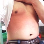 옻닭을 4일쨰 먹는 나!!  사진 첨부