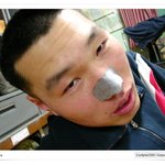 피부에 <b>민감</b>한 군인...