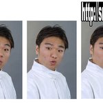 <b>옥동자</b> 성형 수술 3단계 예상도