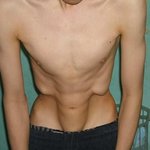 ▒▒ 32. 살아있는 "<b>질럿</b>"