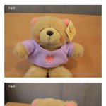 <b>수술전</b>과 <b>수술</b>후 엄청나 졌다!
