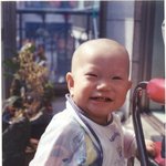 2차수술후 <b>한컷</b>