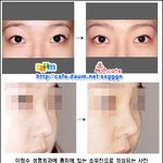 <b>소유진</b> 성형성공 광고사진
