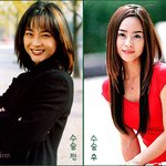 우희진수술<b>전후</b>2