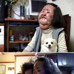 성형수술 부작용은 이렇게 무서운 것