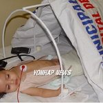 <b>페루</b> '인어아기' 다리수술 성공