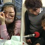 안면장애 변복순<b>씨</b>, "날 못보는 시각장애인위해 평생봉사"