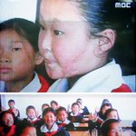 용천역 폭발 <b>상흔</b> 초등학생