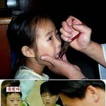 으악!!<b>무쟈</b>게 아프겠다!!