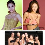 유니 풍선가슴 논란 '성형했다 vs 안했다'