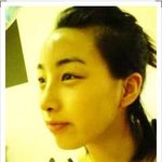 최은화, 코와 <b>이마</b> 수술후 사진