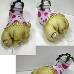 <b>발가락</b> 무