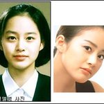 <b>태희</b>! 고등학교땐 영~ --  성형 의혹??