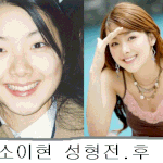 <b>소이현</b> 성형 전. 후 ...