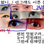 한채영 눈 고치기 <b>전과</b> 후