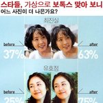 [펌] 여자 연예인들, 보톡스 맞으면 이렇게 된대요^^