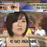 <b>성형</b> 수술의 승리..