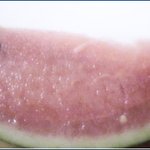 <b>수박</b>의 양면