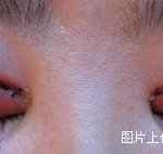 <b>쌍꺼풀</b> <b>수술</b> 장면! 미인되기도 힘드네