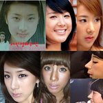 서인영의 코 변화