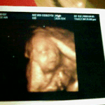 우리 <b>관우</b> 입체초음파 자랑해요^^