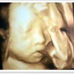 울 <b>연두</b> 입체초음파 사진~^^