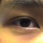 진한 쌍커풀 있는 남자어떻게생각하세요 ?(사진<b>첨부</b>)