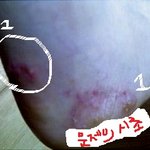 이게진정<b>무좀</b>인가? (사진有)믿을수업어..........ㅠㅠㅠㅠ