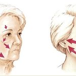 [얼굴<b>주름</b>,<b>이마주름</b>] 팔자<b>주름</b> 피면 팔자가 바뀐다!