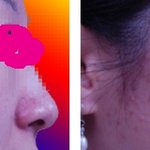 여드름 <b>박멸</b>기...(사진 有재석 떠나지마 ㅠㅠ)