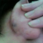 :::: 동생이 퇴근길에 집단 구타 당했습니다. (사진 有)