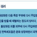 보톡스 필러 [피<b>주사</b>]