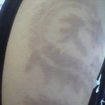 블랙<b>헤나</b> 부작용.!! [사진有]