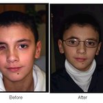 <b>cia</b> 변장 기술자, 다섯 살짜리 소녀에 실리콘 귀 선물