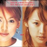 [이효리] 효리도 성형을..성형<b>자료</b> 헉스 ~