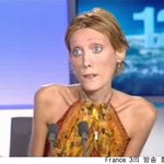 모델로 나선 31kg 거식증 여성! 이제 그만!!