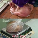 축구공 할머니 방송 이후 혹 뗀 장면