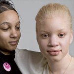 흑인이지만 피부는 <b>백인</b>