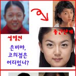강은비.. 성형<b>수술</b>?