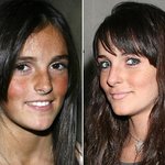 린제이 로한 동생 <b>알리</b> 로한, 최근 깨끗하게 박피 된 피부