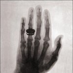 세계 최초의 x선 사진