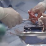 그레이아나토미 귀염둥이 <b>조지</b>의 옥의 티~