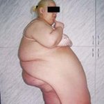 희귀한 몸으로 살아가는 러시아의 <b>여인</b>!