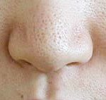 보기싫은 코피지 효과적으로 없애기