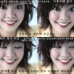 <b>이윤지</b>언니야 병원갔다 바로 광고찍으러 ㄱㄱ?