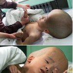 머리만 점점 커지는 아이-너무 <b>불쌍</b>해