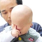 ‘눈이 없이 태어난 아이’에 중국네티즌 ‘눈물’