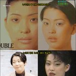 성형<b>수술</b>후 완전용된 연예인3명